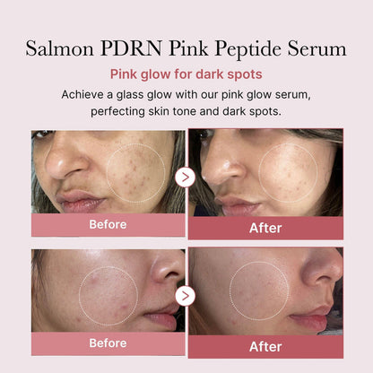 PDRN Pink Peptide Brightening Glow Serum 30ml - Collagen Hydrating & Firming Essence for Radiant Skin | Moisturizing Anti Dullness Facial Serum